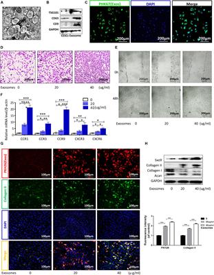 Cartilage Endplate Stem Cells Transdifferentiate Into Nucleus Pulposus Cells via Autocrine Exosomes